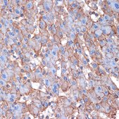 Anti-Alpha Fodrin Antibody, clone 9H5V8, Rabbit Monoclonal