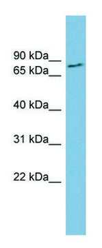 Anti-FURIN (N-terminal) antibody produced in rabbit affinity isolated antibody