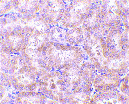 Anti-RIP3 antibody produced in rabbit affinity isolated antibody