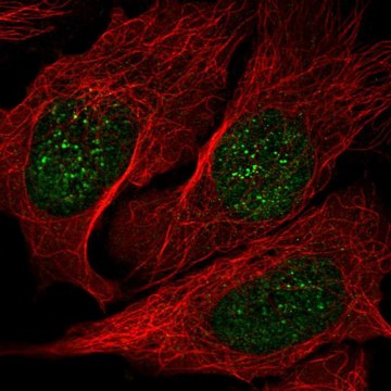 Anti-NME3 antibody produced in rabbit Prestige Antibodies&#174; Powered by Atlas Antibodies, affinity isolated antibody