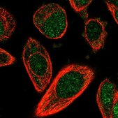 Anti-CHML antibody produced in rabbit Prestige Antibodies® Powered by Atlas Antibodies, affinity isolated antibody