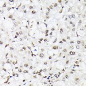 Anti-Phospho-FoxO1-T24/FoxO3a-T32/FoxO4-T28 antibody produced in rabbit