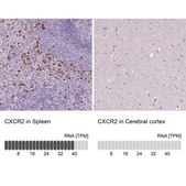 Anti-CXCR2 antibody produced in rabbit Prestige Antibodies® Powered by Atlas Antibodies, affinity isolated antibody, buffered aqueous glycerol solution
