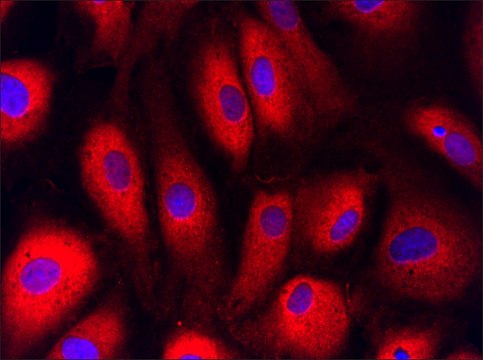 Anti-LDHA (216-228) antibody produced in rabbit IgG fraction of antiserum, buffered aqueous solution