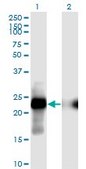 Monoclonal Anti-CITED1 antibody produced in mouse clone 6C1, purified immunoglobulin, buffered aqueous solution