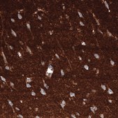 Monoclonal Anti-GAP43 antibody produced in mouse Prestige Antibodies® Powered by Atlas Antibodies, clone CL10847, purified antibody (Protein A)