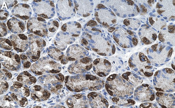 Anti-QPCTL Antibody, clone 5M19 ZooMAb&#174; Rabbit Monoclonal recombinant, expressed in HEK 293 cells