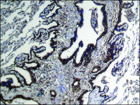 Anti-NUDT10 affinity isolated antibody