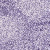 Anti-CLDN10 antibody produced in rabbit Prestige Antibodies® Powered by Atlas Antibodies, affinity isolated antibody, buffered aqueous glycerol solution