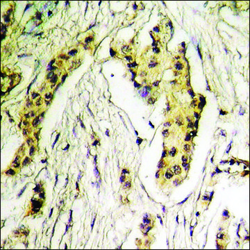 Anti-phospho-HDAC6 (pSer22) antibody produced in rabbit affinity isolated antibody