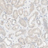 Anti-ATP2B1 antibody produced in rabbit Prestige Antibodies® Powered by Atlas Antibodies, affinity isolated antibody, buffered aqueous glycerol solution