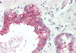 Anti-SLC39A5 (AB1) antibody produced in rabbit affinity isolated antibody