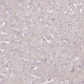 Anti-ARSB antibody produced in rabbit Prestige Antibodies® Powered by Atlas Antibodies, affinity isolated antibody, buffered aqueous glycerol solution