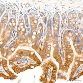 Anti-ROCK2 Antibody, clone 8G3U2, Rabbit Monoclonal