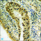 Anti-phospho-BCL-XL (pSer62) antibody produced in rabbit affinity isolated antibody