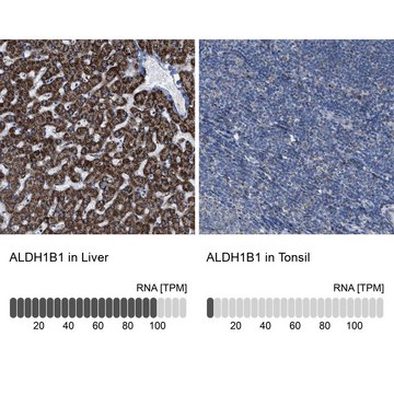 Anti-ALDH1B1 antibody produced in rabbit Prestige Antibodies&#174; Powered by Atlas Antibodies, affinity isolated antibody, buffered aqueous glycerol solution