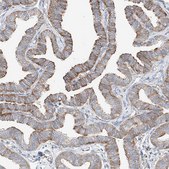 Anti-CRELD1 antibody produced in rabbit Prestige Antibodies® Powered by Atlas Antibodies, affinity isolated antibody, buffered aqueous glycerol solution