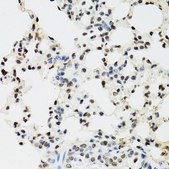 Anti- EDF1 antibody produced in rabbit