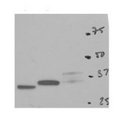 Anti-PYCR2 affinity isolated antibody