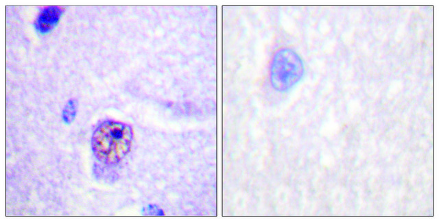 Anti-SF1, N-Terminal antibody produced in rabbit affinity isolated antibody