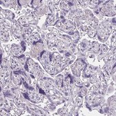 Anti-TENM4 antibody produced in rabbit Prestige Antibodies® Powered by Atlas Antibodies, affinity isolated antibody