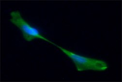 Anti-Neurofilament 160 antibody, Mouse monoclonal clone NN18, purified from hybridoma cell culture