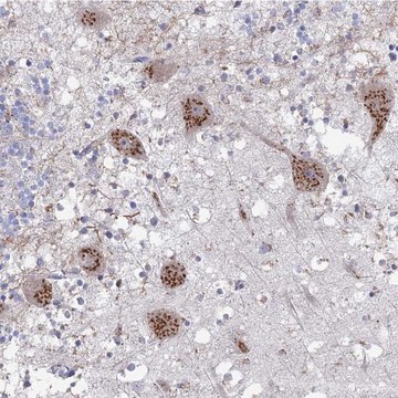 Anti-PITX3 antibody produced in rabbit Prestige Antibodies&#174; Powered by Atlas Antibodies, affinity isolated antibody, buffered aqueous glycerol solution