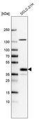 Anti-LHX8 antibody produced in rabbit Prestige Antibodies® Powered by Atlas Antibodies, affinity isolated antibody