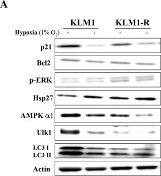 Anti-ULK1 antibody produced in rabbit ~1.0&#160;mg/mL, affinity isolated antibody