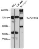 Anti-RPA70/RPA1 Antibody, clone 5R7S3, Rabbit Monoclonal