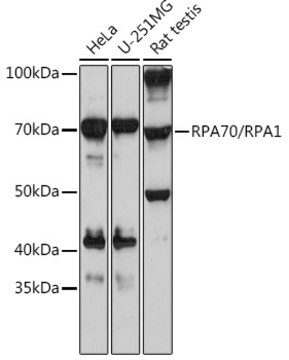 Anti-RPA70/RPA1 Antibody, clone 5R7S3, Rabbit Monoclonal