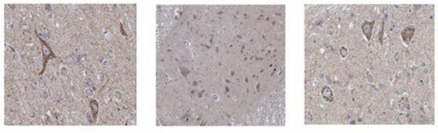 Anti-Fezf2 Antibody from rabbit, purified by affinity chromatography