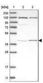 Anti-IFT57 antibody produced in rabbit Prestige Antibodies® Powered by Atlas Antibodies, affinity isolated antibody, buffered aqueous glycerol solution