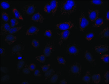Anti-MR−Pro ADM antibody produced in rabbit
