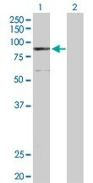 Anti-ELAC2 antibody produced in rabbit purified immunoglobulin, buffered aqueous solution