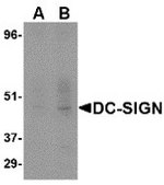 Monoclonal Anti-DC-SIGN [5D7] antibody produced in mouse affinity purified immunoglobulin (IgG)