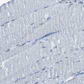 Anti-GOLM1 antibody produced in rabbit Prestige Antibodies® Powered by Atlas Antibodies, affinity isolated antibody, buffered aqueous glycerol solution