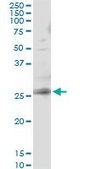 Monoclonal Anti-RAB3B, (C-terminal) antibody produced in mouse clone 1A7, purified immunoglobulin, buffered aqueous solution