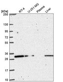 Anti-CCDC69 antibody produced in rabbit Prestige Antibodies® Powered by Atlas Antibodies, affinity isolated antibody