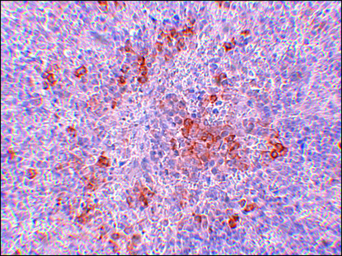 抗 AGTR1 兔抗 affinity isolated antibody, buffered aqueous solution