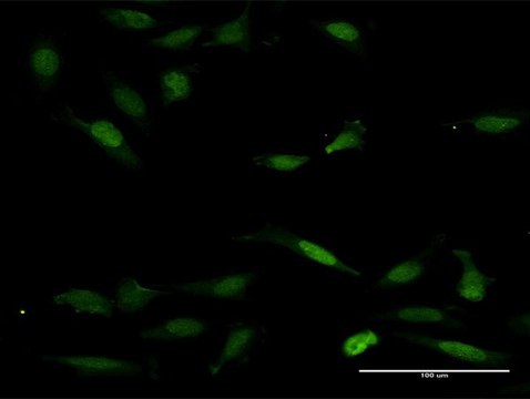 Anti-NFAT5 antibody produced in mouse purified immunoglobulin, buffered aqueous solution