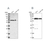 Anti-DARS2 antibody produced in rabbit Prestige Antibodies® Powered by Atlas Antibodies, affinity isolated antibody, buffered aqueous glycerol solution, Ab1