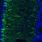 Anti-ARFGEF1 antibody produced in rabbit Prestige Antibodies® Powered by Atlas Antibodies, affinity isolated antibody, buffered aqueous glycerol solution, Ab2