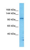 Anti-ST18 affinity isolated antibody
