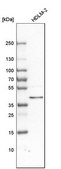 Anti-PPID antibody produced in rabbit Prestige Antibodies® Powered by Atlas Antibodies, affinity isolated antibody, buffered aqueous glycerol solution, Ab1