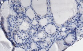 Anti-Endoplasmin/GRP94 Antibody, clone 4G22 ZooMAb® Rabbit Monoclonal recombinant, expressed in HEK 293 cells