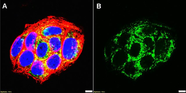 Anti-TGF &#946; receptor 1 Antibody, clone 4H18 ZooMAb&#174; Rabbit Monoclonal recombinant, expressed in HEK 293 cells