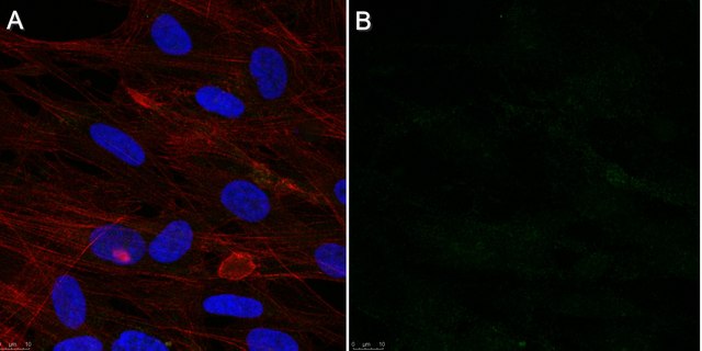 Anti-Cytomegalovirus Antibody, clone 8B1.2 clone 8B1.2, Chemicon&#174;, from mouse