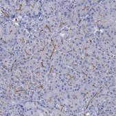 Anti-CFTR antibody produced in rabbit Prestige Antibodies® Powered by Atlas Antibodies, affinity isolated antibody, buffered aqueous glycerol solution