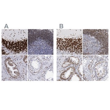 Anti-MECP2 antibody produced in rabbit Ab1, Prestige Antibodies&#174; Powered by Atlas Antibodies, affinity isolated antibody, buffered aqueous glycerol solution